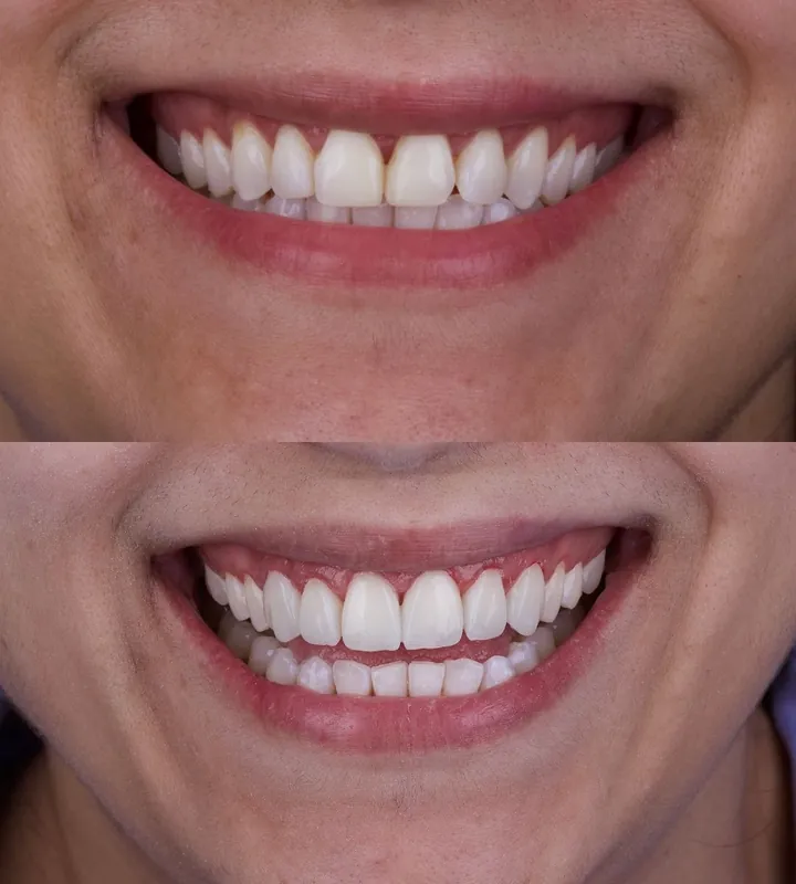 Antes e depois — caso 9
